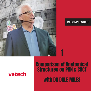 Comparison of Anatomical Structures on PAN and CBCT - Radiographer, Dr Dale Miles [1 of 2]