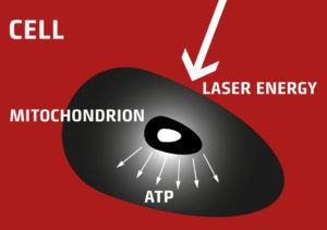 Special Characteristics of Laser Light (PBM)
