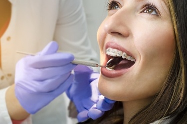 Brace Yourself: Laser-assisted Orthodontics are Trending